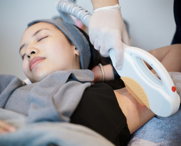 Trị Thâm Nách Tại Sen Beauty